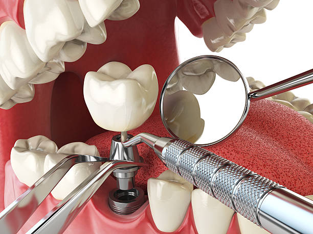 Best Broken or Cracked Tooth Emergency Dentist in Lafayette, GA