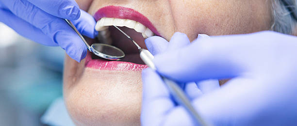 Best Emergency Dental Extractions in Lafayette, GA